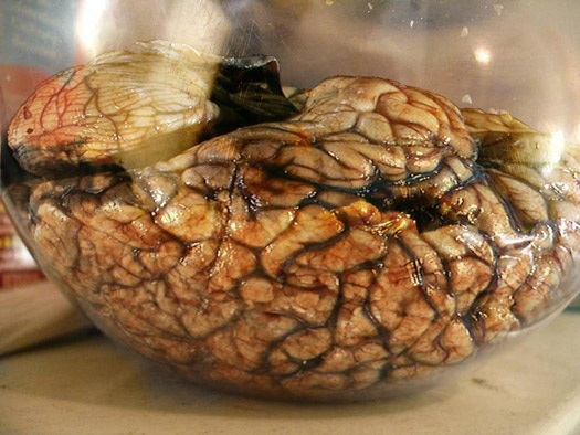 Brain Bowl