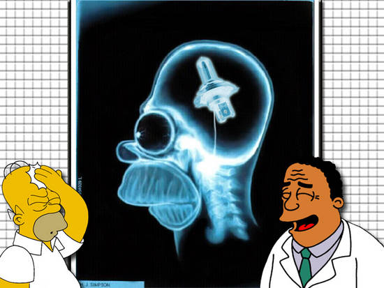 Homer's Brain