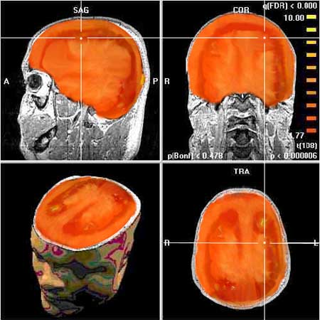 mr. tomato MRI :-D