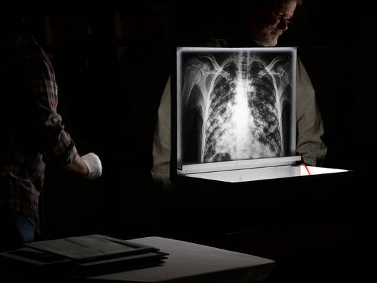 Portable X-Ray Machine