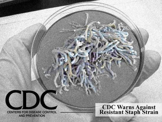 CDC Warning - !!!!