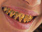 Wooden Teeth